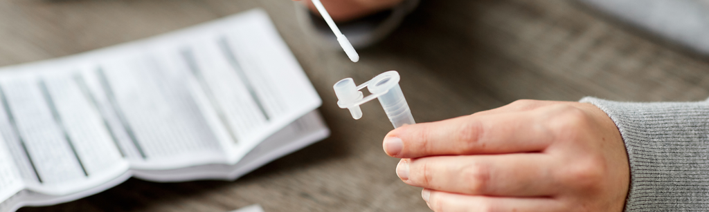 How to carry out an STI test