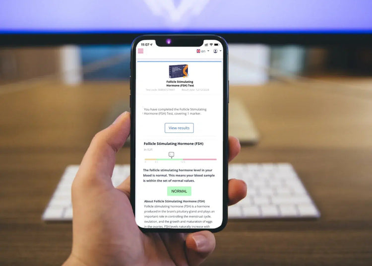 Follikel stimulierendes Hormon (FSH) Test