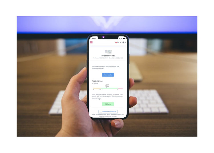 Testosteron Test