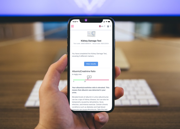 Test auf Nierenschäden