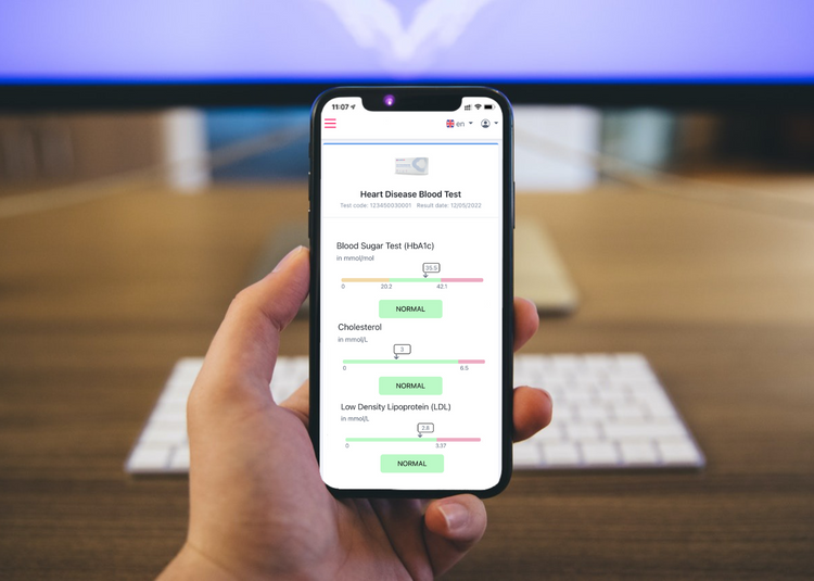 Herzgesundheits-Test