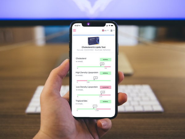 Umfassender Cholesterin-Test