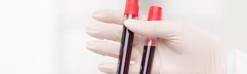 Hämoglobin: Was ein niedriger Hämoglobinspiegel für Ihre Gesundheit bedeuten kann
