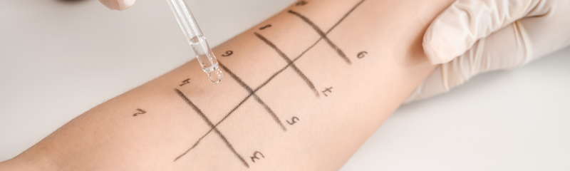How to test for inhalation allergies? Methods and options for allergy diagnosis