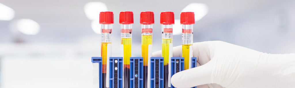 What can you test at home?